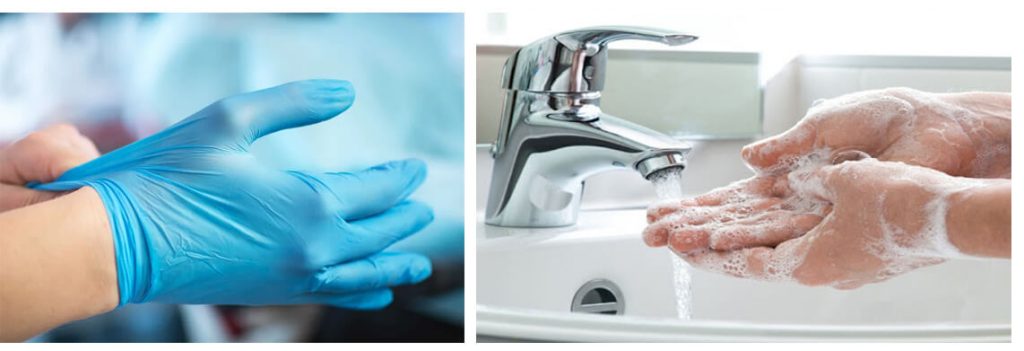 Nên đeo găng tay, rửa tay thật sạch sau khi tiếp xúc với chó nhiễm bệnh xoắn khuẩn vàng da ở chó