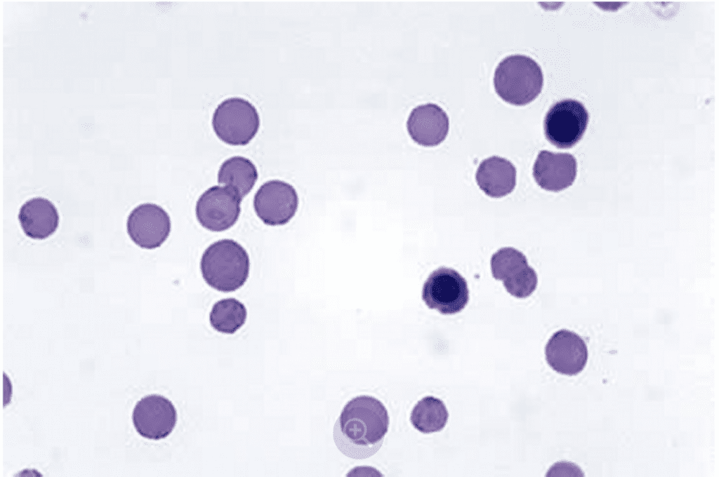Haemobartonella felis, phết máu ngoại biên ở mèo | Ký sinh trùng máu Hemotropic Mycoplasmas (Hemoplasmas) ở chó mèo