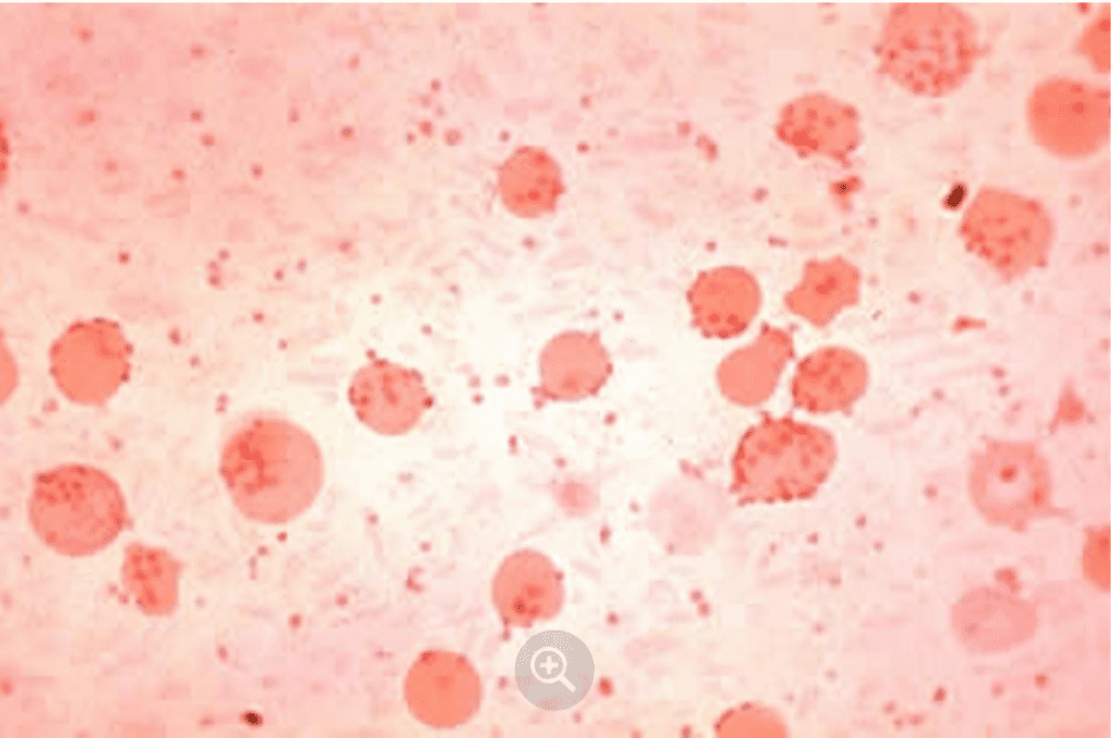 Mycoplasma (Eperythrozoon) suis, phết máu ngoại biên ở heo | Ký sinh trùng máu Hemotropic Mycoplasmas (Hemoplasmas) ở chó mèo